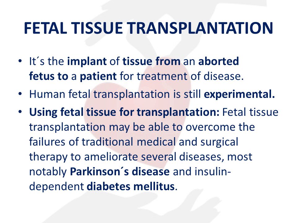 History of Fetal Tissue Research and Transplants
